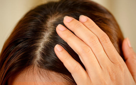 Frau die ihre Hand in ihren Kopf hält. Im Fokus die Kopfhaut. 